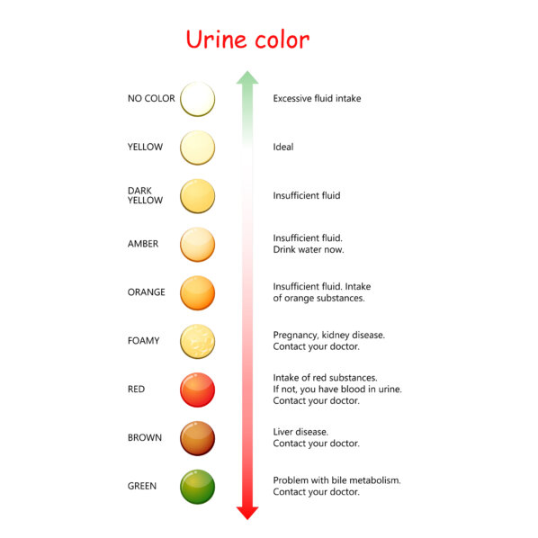 Urine Color Chart 